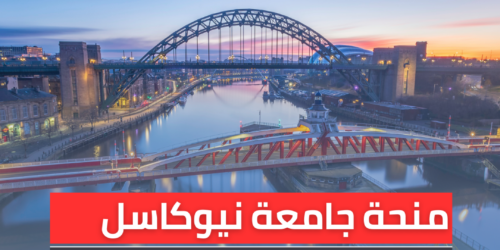 منحة جامعة نيوكاسل