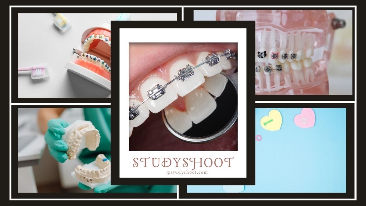 دراسة ماجستير تقويم الأسنان في أفضل الجامعات