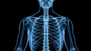 أوسبيلدونغ أشعة سينية