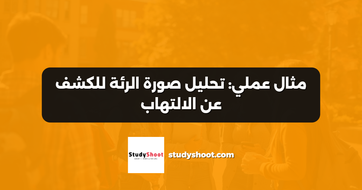 مثال عملي: تحليل صورة الرئة للكشف عن الالتهاب